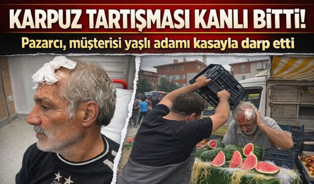 Karpuz Tartışması Kanlı Bitti: Pazarcı Yaşlı Adamı Kasayla Darp Etti