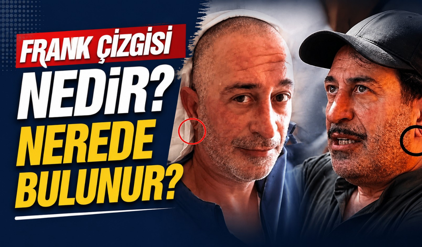 Frank çizgisi nedir? Frank çizgisi nerede bulunur?